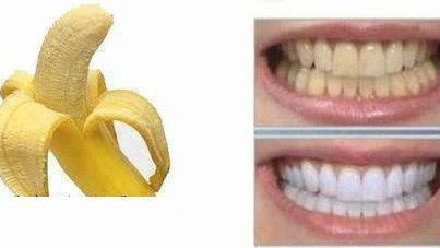 Peau de banane et dents